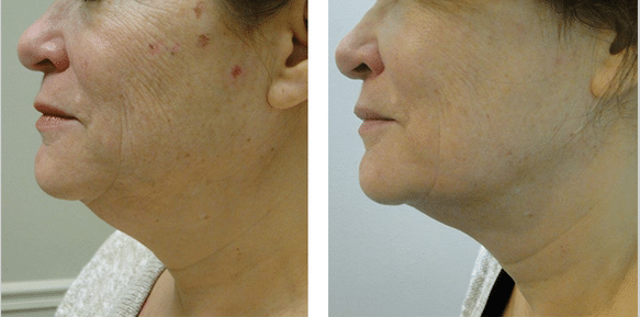 AGING FACE NECK C