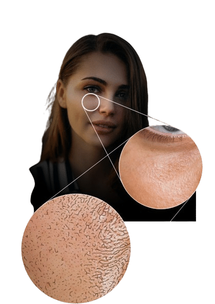FOCUSKIN ANALYSIS GIRL WITH SKIN BUBBLES